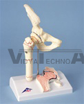 Femoral Fracture and Hip Osteoarthritis Model